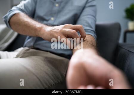 Nahaufnahme einer afrikanischen Mann seine Hand Kratzen Stockfoto