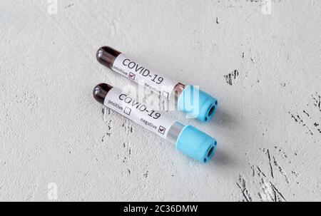 Reagenzglas mit Blutprobe für COVID-19-Test Stockfoto