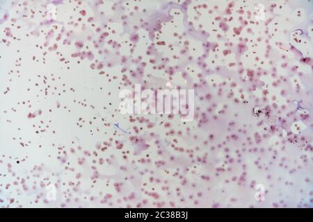 Blaue Flecken des Farbstoffes in der weißen Wanne lösen sich in Wasser auf. Stockfoto