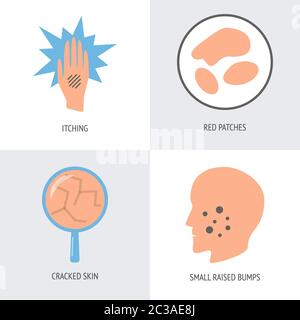 Ekzem Symptome Symbol in flacher Form gesetzt. Hautallergiesymbole isoliert. Medizinische Vektordarstellung. Stock Vektor