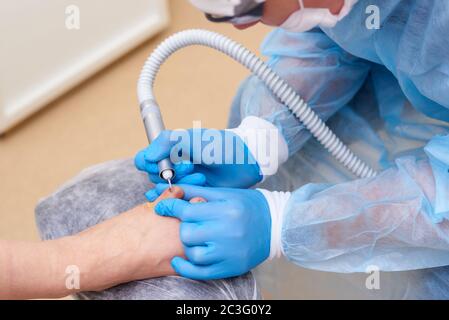 Behandlung von Pilzerkrankungen der Haut der Füße und Nägel. Stockfoto