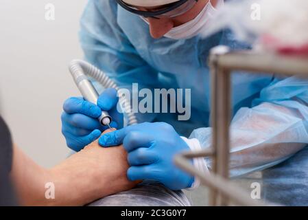 Behandlung von Pilzerkrankungen der Haut der Füße und Nägel. Stockfoto