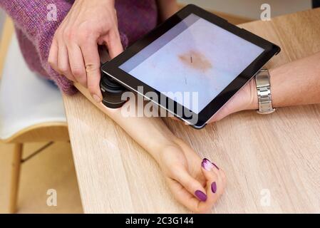 Eine sichere Methode zur Diagnose von Hautkrankheiten. Untersuchung von Muttermalen und anderen Hautläsionen.Prävention von gefährlichen Hautkrankheiten. Stockfoto