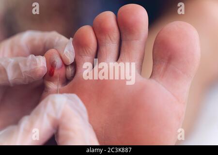 Finger verletzt Mann zu Besuch Frau Arzt Traumatologe Stockfoto