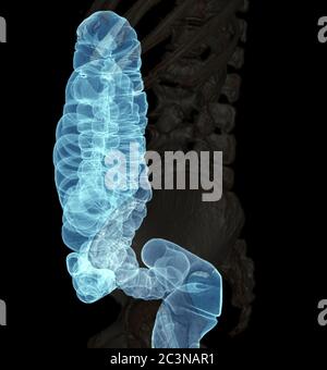 CT-Kolonographie oder CT-Scan von Colon 3D-Rendering-Bild laterale Ansicht des Dickdarms für das Screening von Kolorektalkrebs. Check up Screening Colon Krebs. Stockfoto