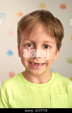 Kind zeigt fehlende Zähne, er hat zwei Kalbszähne verloren. Nahaufnahme Porträt des blonden kaukasischen Jungen lächeln ohne zwei Vorderzähne. Stockfoto