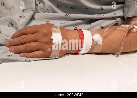 Arm und Hand eines Mannes in einem Krankenhauskleid, IV, Armbänder, Kopierraum, horizontaler Aspekt Stockfoto
