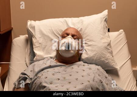 Alter kahler Mann in einem Atemgerät in einem Krankenhausbett, der auf einem Kissen schläft, Coronavirus, Krebs, Chemotherapie, horizontaler Aspekt Stockfoto