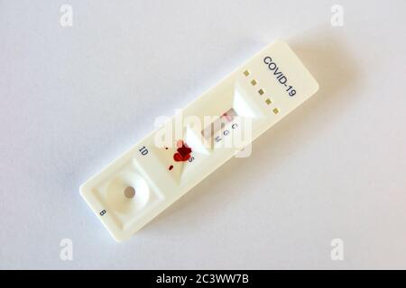 NHS-Antikörper-Test zu Hause auf Coronavirus oder Covid 19, der im Rahmen eines Forschungsprojekts verwendet wurde, um zu schätzen, wie viele im Juni 2020 infiziert wurden. Stockfoto