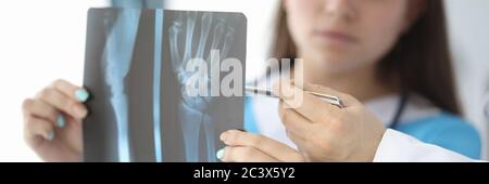 Arzt über Röntgenaufnahmen des Patienten Stockfoto