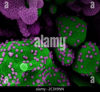 Neues Coronavirus SARS-CoV-2 Koloriertes Rasterelektronenmikroskopisch einer Apoptose (grün), die mit SARS-COV-2-Viruspartikeln (violett) stark infiziert ist und aus einer Patientenprobe isoliert wurde. Bild an der NIAID Integrated Research Facility (IRF) in Fort Detrick, Maryland. Stockfoto