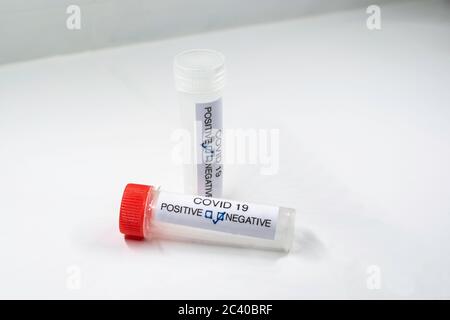 Prüfung auf Vorhandensein von Coronavirus. Röhrchen mit einer Tupfer-Probe, die positiv auf COVID-19 getestet wurde. Stockfoto