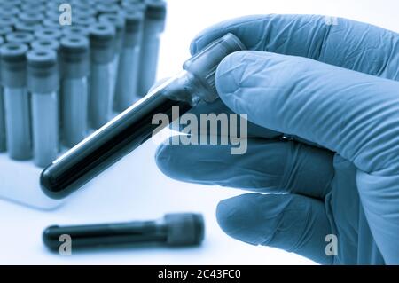 Blutanalyse, klinische oder medizinische Tests und Phlebotomie Konzept Thema mit Nahaufnahme auf Arzt Hand trägt blaue Latexhandschuhe und hält eine Testwanne Stockfoto