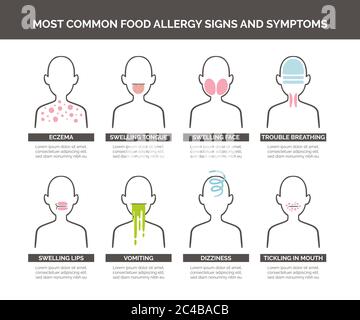 Die häufigsten Anzeichen und Symptome einer Lebensmittelallergie sind eingestellt. Vektorgrafik. Stock Vektor