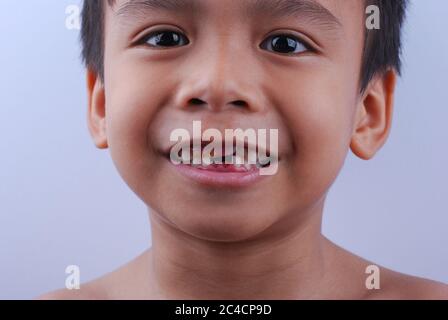 Kuala Lumpur, Malaysia - 8. Dezember 2019 : netter kleiner asiatischer Junge lächelt und zeigt Zähne gebrochen in Kuala Lumpur, Malaysia. Stockfoto