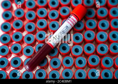 Nahaufnahme eines Blutteströhrchens mit rotem Deckel Für Coronavirus auf mehreren leeren Röhrchen Stockfoto