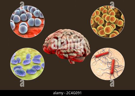 Ursachen der bakteriellen Meningitis, Computer-Illustration. Neisseria meningitidis, Streptococcus pneumoniae, Haemophilus influenzae und Listeria monocytogenes Bakterien, die wichtigsten Erreger der bakteriellen Meningitis. Stockfoto