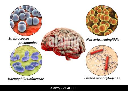 Ursachen der bakteriellen Meningitis, Computer-Illustration. Neisseria meningitidis, Streptococcus pneumoniae, Haemophilus influenzae und Listeria monocytogenes Bakterien, die wichtigsten Erreger der bakteriellen Meningitis. Beschriftetes Bild. Stockfoto