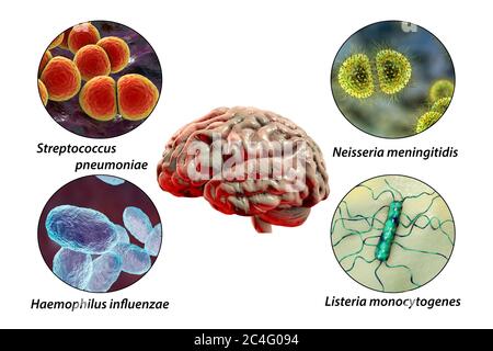 Ursachen der bakteriellen Meningitis, Computer-Illustration. Neisseria meningitidis, Streptococcus pneumoniae, Haemophilus influenzae und Listeria monocytogenes Bakterien, die wichtigsten Erreger der bakteriellen Meningitis. Beschriftetes Bild. Stockfoto