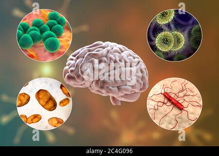 Ursachen der bakteriellen Meningitis, Computer-Illustration. Neisseria meningitidis, Streptococcus pneumoniae, Haemophilus influenzae und Listeria monocytogenes Bakterien, die wichtigsten Erreger der bakteriellen Meningitis. Stockfoto