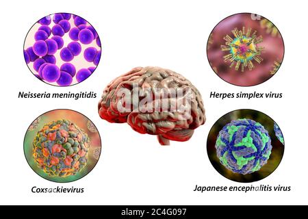 Hirninfektionen. Computer-Illustration von Mikroorganismen, die Enzephalitis und Meningitis verursachen. Beschriftetes Bild. Stockfoto