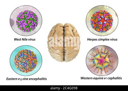 Hirninfektionen. Computer-Illustration von Mikroorganismen, die Enzephalitis und Meningitis verursachen. Beschriftetes Bild. Stockfoto