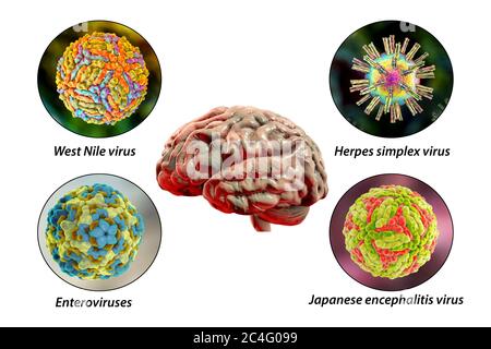 Hirninfektionen. Computer-Illustration von Mikroorganismen, die Enzephalitis und Meningitis verursachen. Beschriftetes Bild. Stockfoto