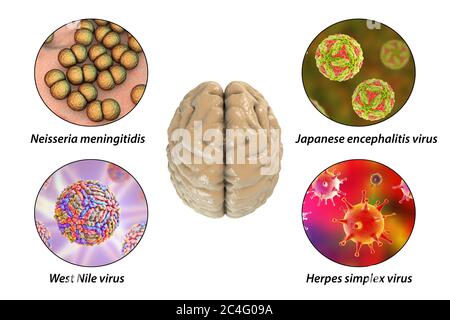 Hirninfektionen. Computer-Illustration von Mikroorganismen, die Enzephalitis und Meningitis verursachen. Beschriftetes Bild. Stockfoto