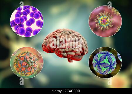 Hirninfektionen. Computer-Illustration von Mikroorganismen, die Enzephalitis und Meningitis verursachen. Stockfoto