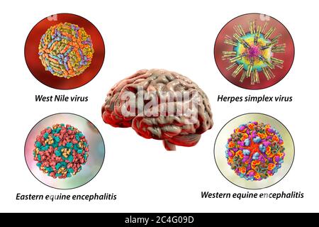 Hirninfektionen. Computer-Illustration von Mikroorganismen, die Enzephalitis und Meningitis verursachen. Beschriftetes Bild. Stockfoto