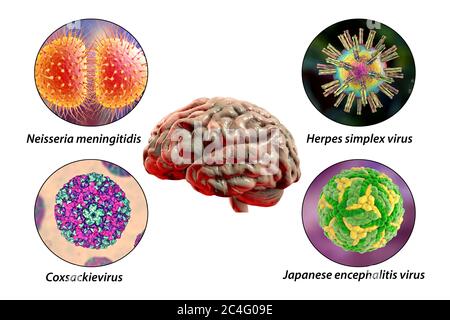 Hirninfektionen. Computer-Illustration von Mikroorganismen, die Enzephalitis und Meningitis verursachen. Beschriftetes Bild. Stockfoto