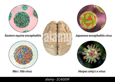 Hirninfektionen. Computer-Illustration von Mikroorganismen, die Enzephalitis und Meningitis verursachen. Beschriftetes Bild. Stockfoto