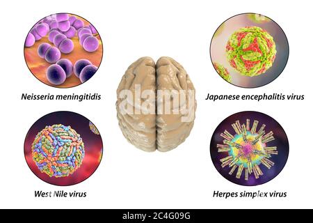 Hirninfektionen. Computer-Illustration von Mikroorganismen, die Enzephalitis und Meningitis verursachen. Beschriftetes Bild. Stockfoto