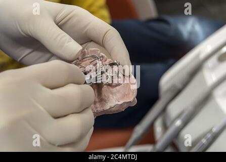 Kieferorthopädische Expander Detail von den Händen des Zahnarztes gehalten Stockfoto