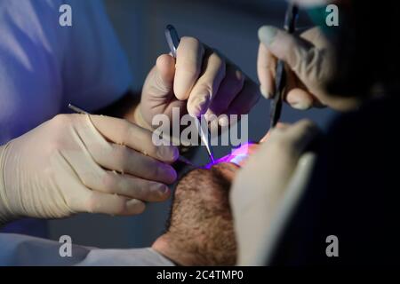 Dresden, Deutschland. Juni 2020. ILLUSTRATION - Zahnarzt Conrad Kühnöl (l) und ein Dentalhygieniker untersuchen einen Patienten mit einem Fluoreszenzmikroskop in der Zahnarztpraxis. (Posed Scene) (to dpa 'mit High-Tech aus der Corona-Krise: Dresdner Zahnarzt setzt auf Digital') Quelle: Robert Michael/dpa-Zentralbild/dpa/Alamy Live News Stockfoto