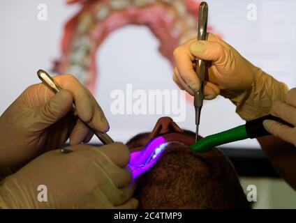 Dresden, Deutschland. Juni 2020. ILLUSTRATION - Zahnarzt Conrad Kühnöl (l) und ein Dentalhygieniker untersuchen einen Patienten mit einem Fluoreszenzmikroskop in der Zahnarztpraxis. (Posed Scene) (to dpa 'mit High-Tech aus Corona-Krise: Dresdner Zahnarzt setzt auf Digital') Quelle: Robert Michael/dpa-Zentralbild/dpa/Alamy Live News Stockfoto