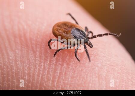 Weibliche Hirsche ticken auf der Haut des menschlichen Fingers. Ixodes ricinus oder scapularis. Nahaufnahme von parasitärer Milbe in dynamischer Bewegung auf der Fingerspitze Stockfoto