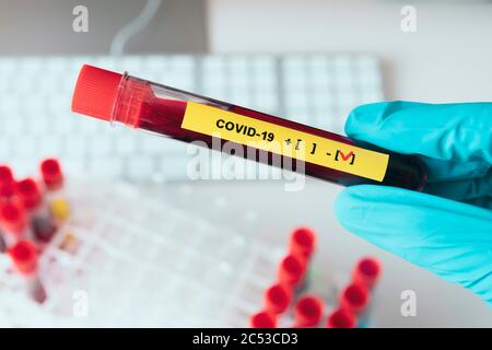 Laborian's Hand zeigt ein negatives Ergebnis covid-19 Teströhrchen im Coronavirus Labor. Stockfoto