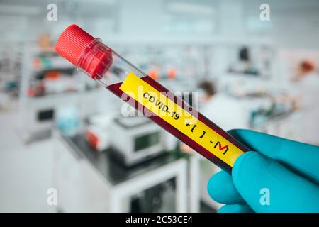 Laborian's Hand zeigt ein negatives Ergebnis covid-19 Teströhrchen im Coronavirus Labor. Stockfoto