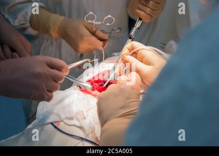 Ein Chirurg mit Assistenten, in einem sterilen Operationssaal, wird an inneren Organen operiert. Stockfoto