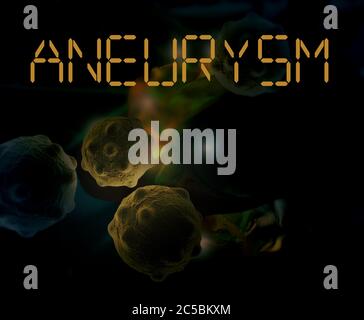 3d Medizinische Illustration des Gehirns Aneurysma Stockfoto