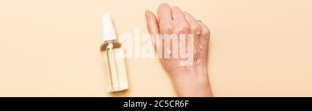 Panorama-Aufnahme der weiblichen Hand mit trockener, exfoliierter Haut in der Nähe von antiseptischem Spray auf Beige Stockfoto