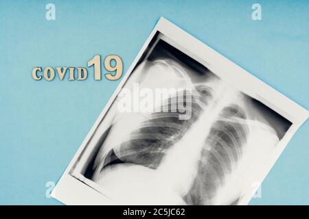 Coronavirus, covid-19. Die Inschrift covid-19 und Röntgenaufnahme der Lunge auf blauem Hintergrund. Selbstisolation und Quarantäne, Lungenentzündung Stockfoto