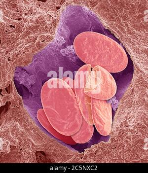 Schlange rote Blutkörperchen. Farbiger Rasterelektronenmikrograph (SEM) von ganzen und gebrochenen roten Blutkörperchen (Erythrozyten, rot) in einem kleinen Blutgefäß einer Schlange. Diese Zellen enthalten Hämoglobin, ein Pigment, das es ihnen ermöglicht, Sauerstoff um den Körper zu transportieren. Nicht-Säugetier rote Blutkörperchen (wie diese) sind oval (discoid) in Form und enthalten einen Zellkern. Menschliche rote Blutkörperchen sind scheibenförmig und haben keinen Zellkern. Vergrößerung: x3000 bei 10 Zentimeter Breite. Stockfoto