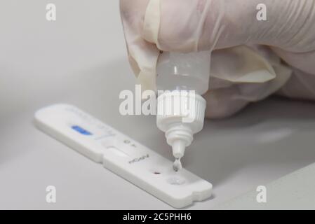 DUQUE DE CAXIAS,(BRASILIEN),MAI,22,2020:Test auf Covid-19, Coronavirus in rio de janeiro in brasilien im Moacyr do Carmos Krankenhaus in Duque de Caxias Stockfoto