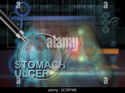 hi-Tech Infografiken von Magengeschwüren in 3d-Software gemacht Stockfoto