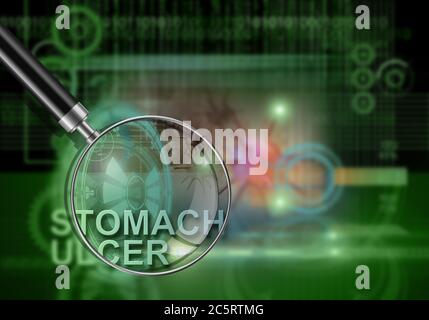 hi-Tech Infografiken von Magengeschwüren in 3d-Software gemacht Stockfoto