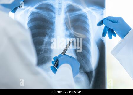 Nahaufnahme. Ärzte in Schutzkleidung diskutieren eine Röntgenaufnahme der Lunge . Stockfoto