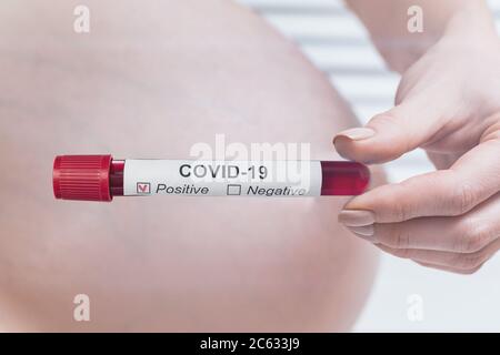 Schwangere Frau hält Reagenzglas mit Blut für 2019-nCoV Analyse. Coronavirus während der Schwangerschaft. Stockfoto