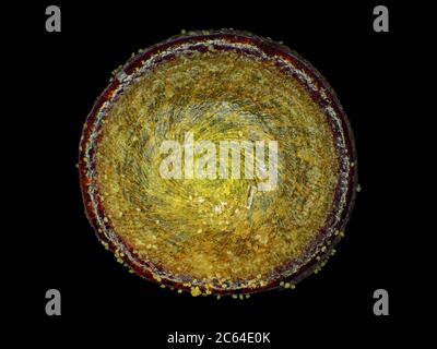 Moos Operculum (Sporenkapseldeckel), ca. 0,9 mm Durchmesser, unter dem Mikroskop Stockfoto